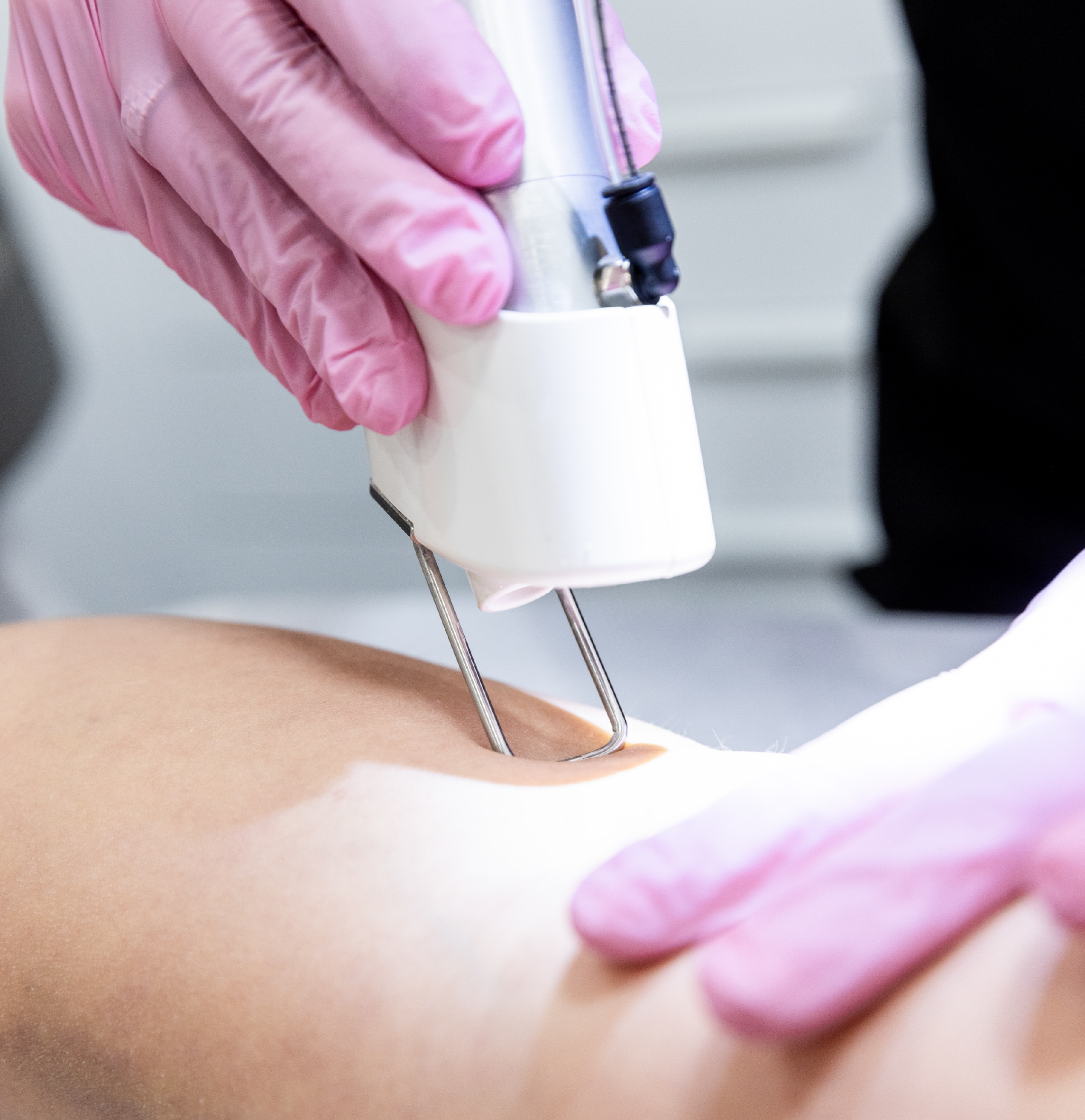 Soin Laser — Espace Mona Fazaa