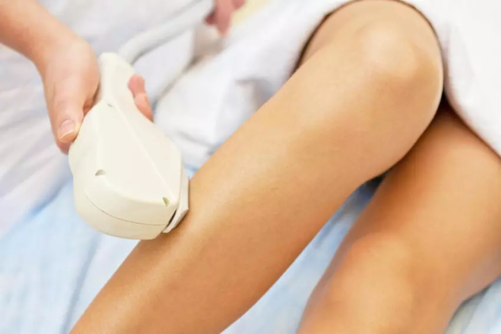 Varicose Vein Treatment